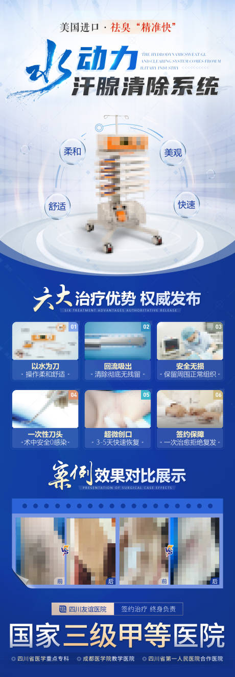源文件下载【腋臭治疗技术仪器介绍医疗长图海报】编号：86280017959517432