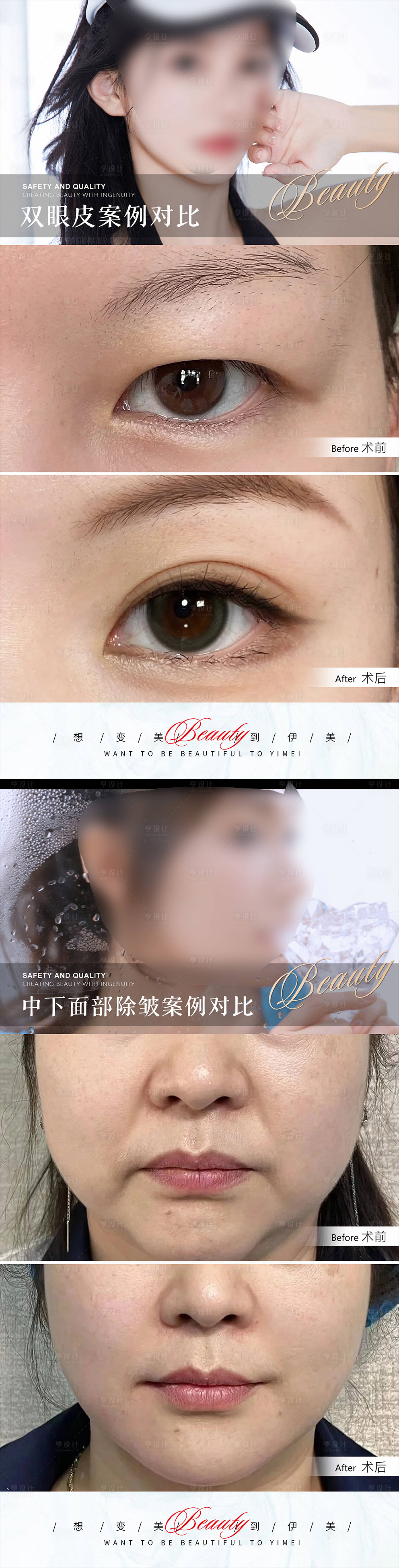 源文件下载【享设计】搜索编号：69700018280845965【医美案例对比海报】