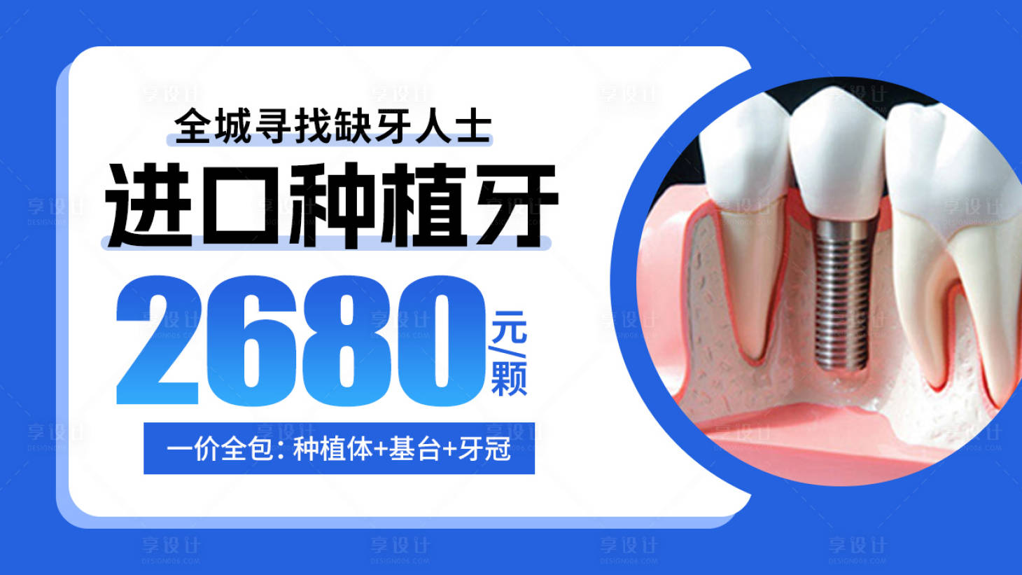 源文件下载【享设计】搜索编号：13600018086779297【种植牙海报】