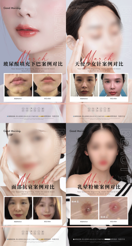 源文件下载【整形案例合集】编号：33980018062179627