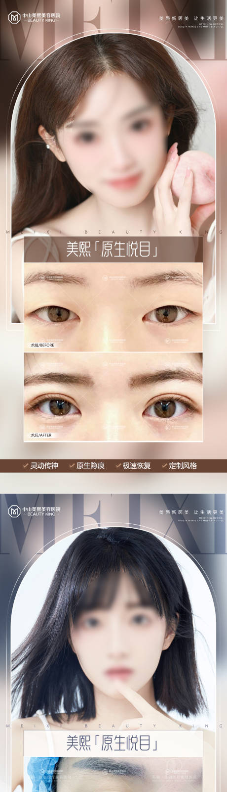 源文件下载【医美双眼皮案例海报】编号：36470017750233643