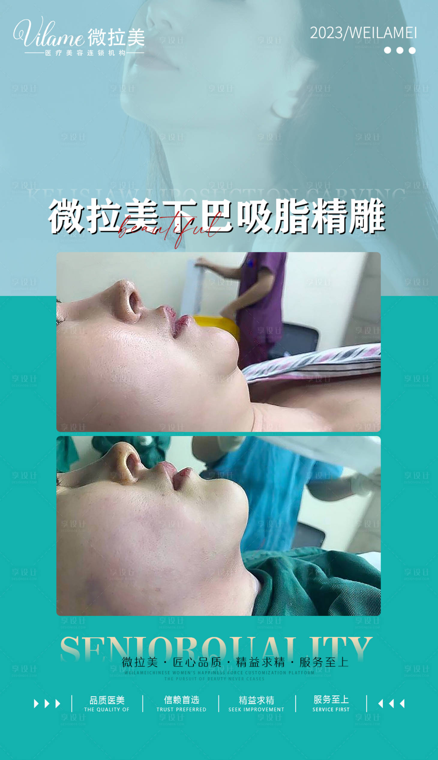 源文件下载【享设计】搜索编号：67690017986891033【医美案例对比图海报 】