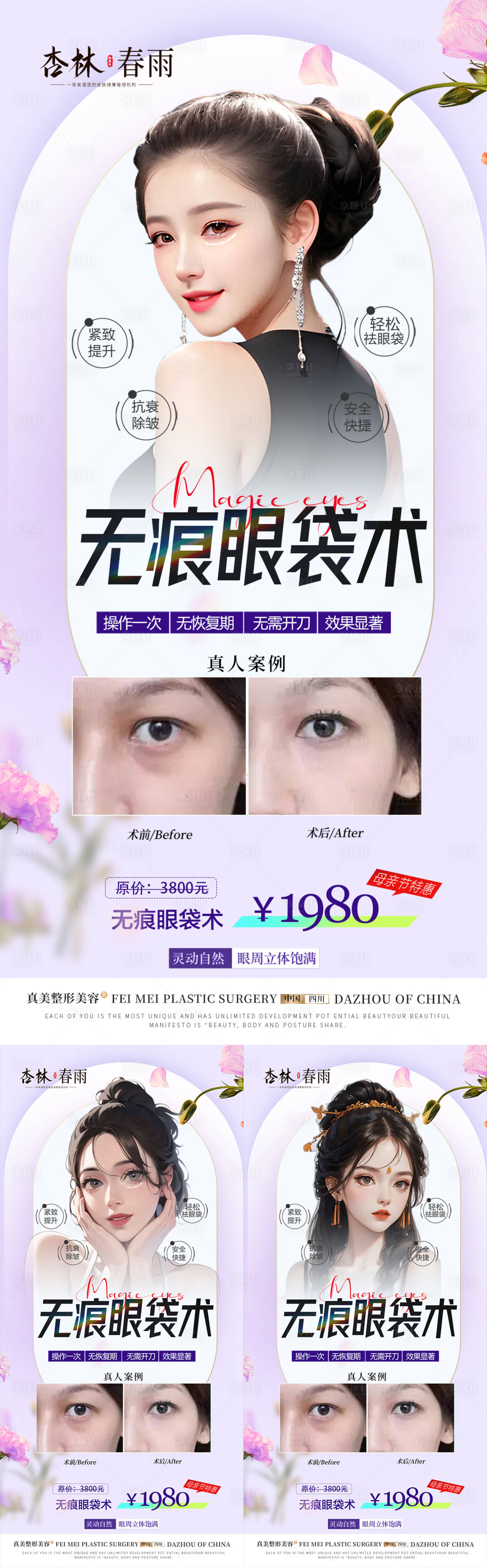 源文件下载【祛眼袋案例活动】编号：53620018148042073