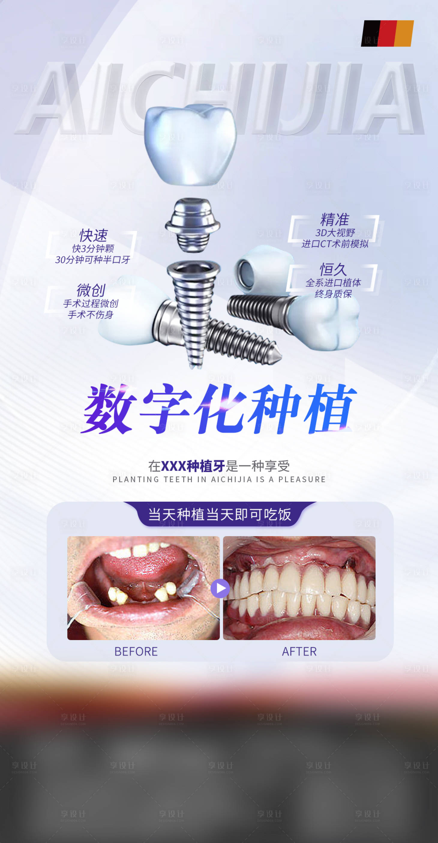 源文件下载【口腔种植牙优势科普】编号：67650018076543399
