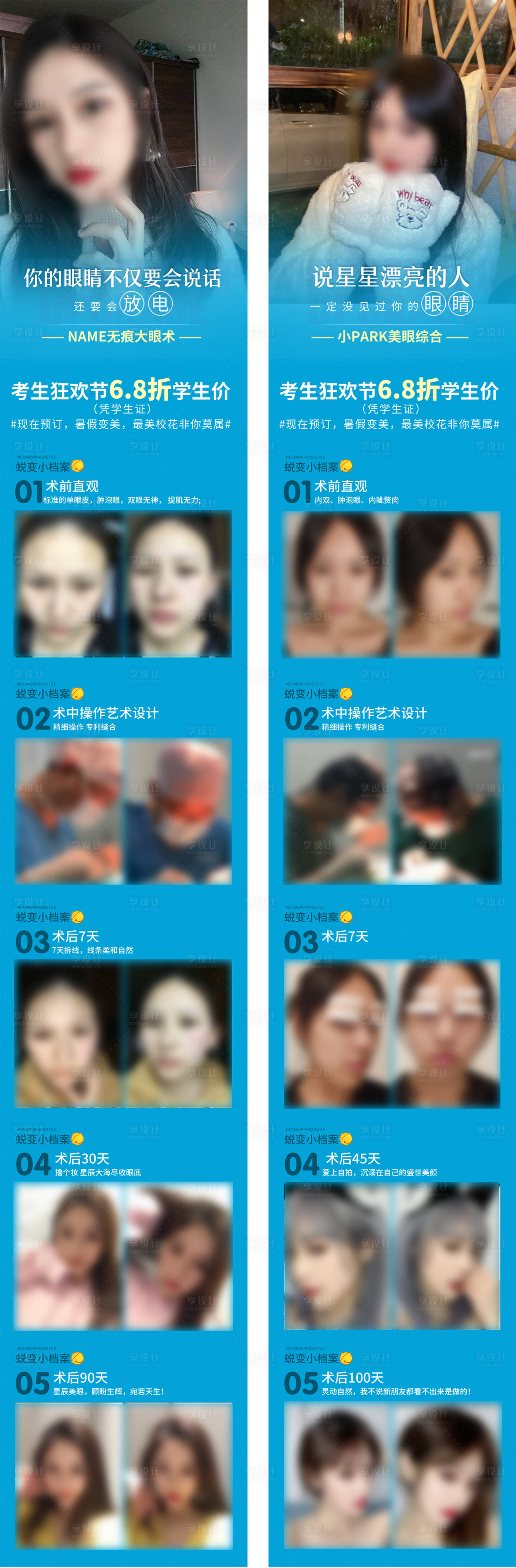 源文件下载【享设计】搜索编号：95650018240068563【双眼皮案例 长图海报】