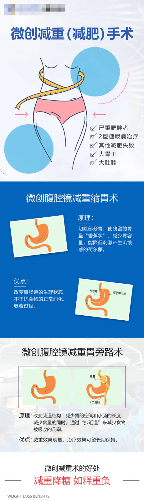 源文件下载【微创减重手术长图专题设计】编号：41600018229504721