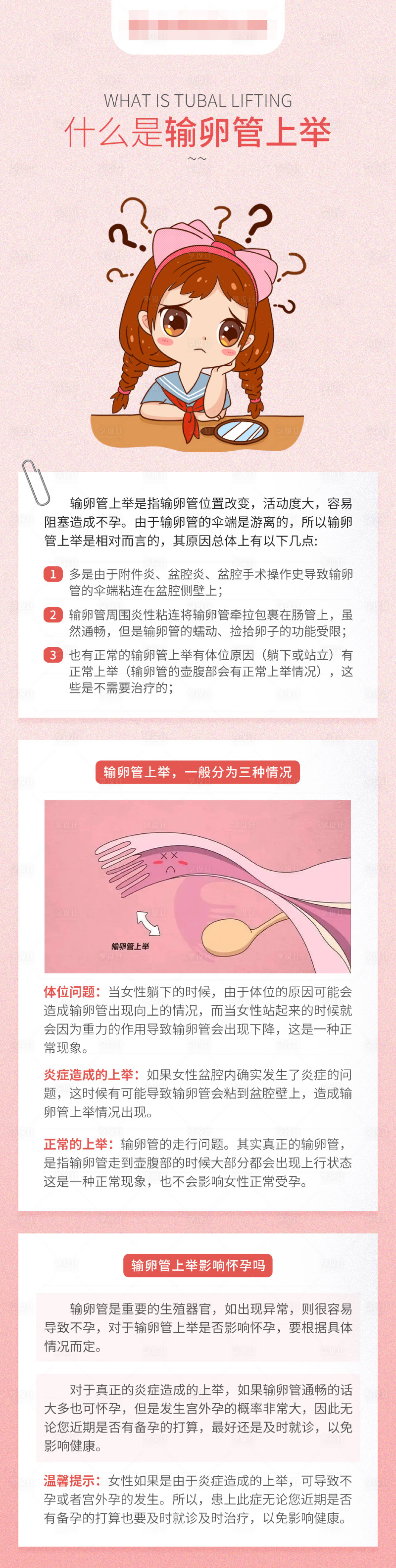 源文件下载【享设计】搜索编号：93030017945217540【医疗科普长图海报】