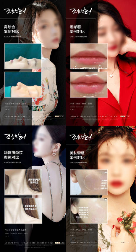 源文件下载【医美案例对比系列海报】编号：33110017872386242