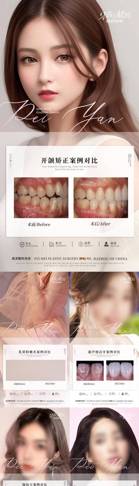 源文件下载【医美整形口腔案例】编号：11420017743079053