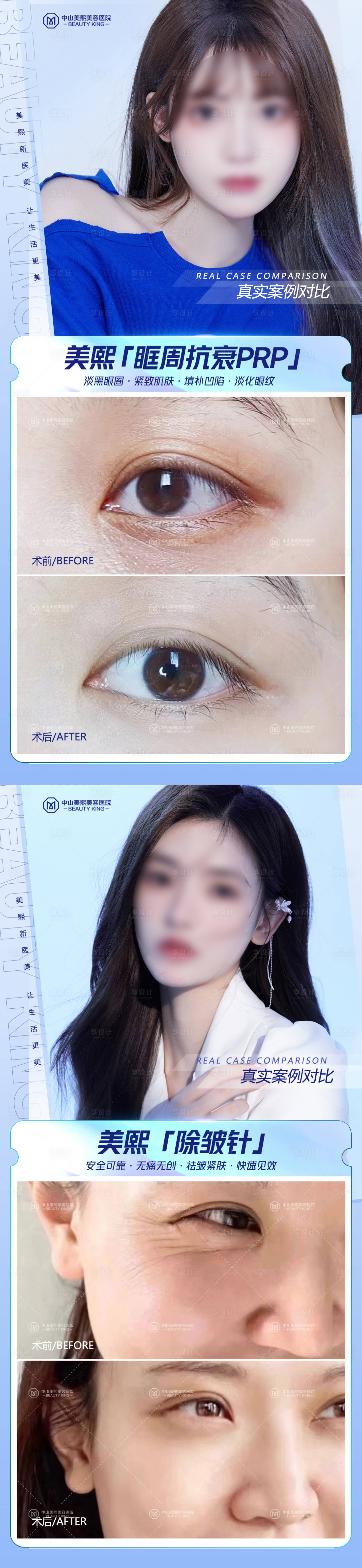 源文件下載【享設計】搜索編號：64110017834845636【醫美眼周抗衰案例海報】