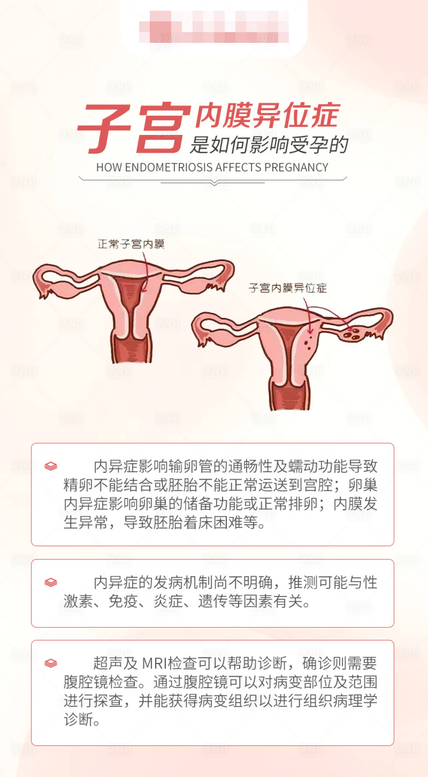 源文件下載【享設計】搜索編號：89070018232532236【子宮內膜異位癥如何影響受孕海報】