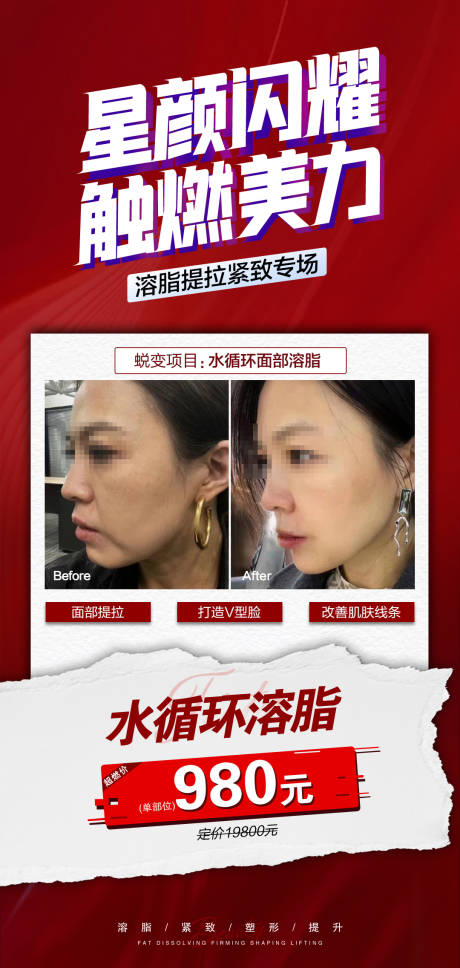 源文件下载【溶脂活动海报】编号：67000017977237956