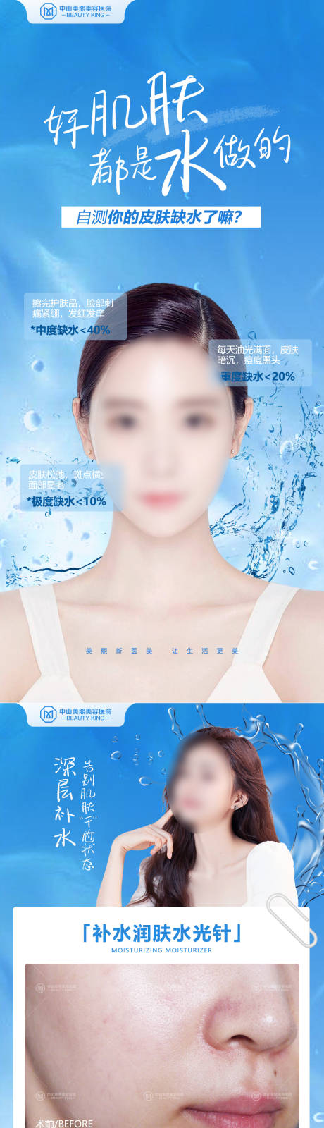 源文件下载【水光针功效案例海报】编号：68570018137156886