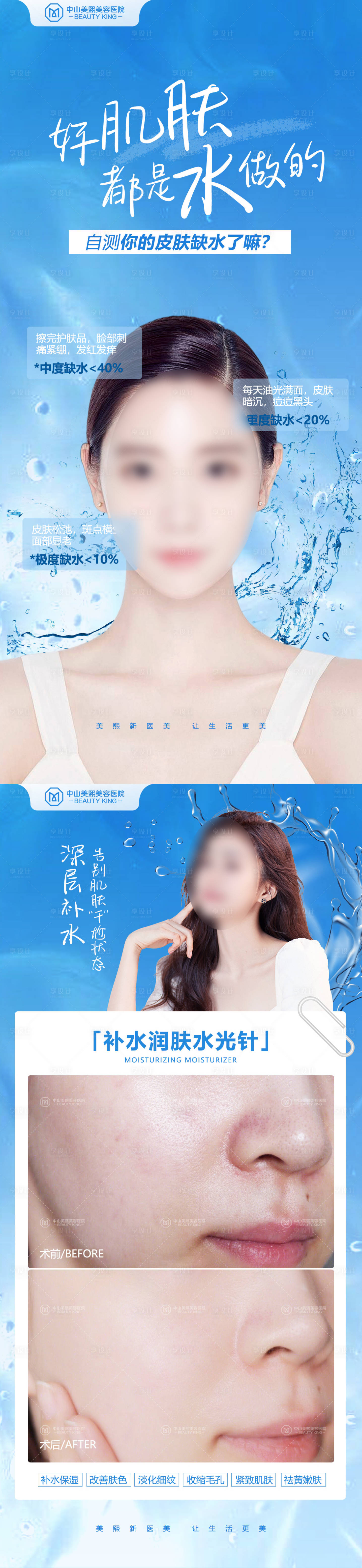 源文件下載【享設計】搜索編號：68570018137156886【水光針功效案例海報】