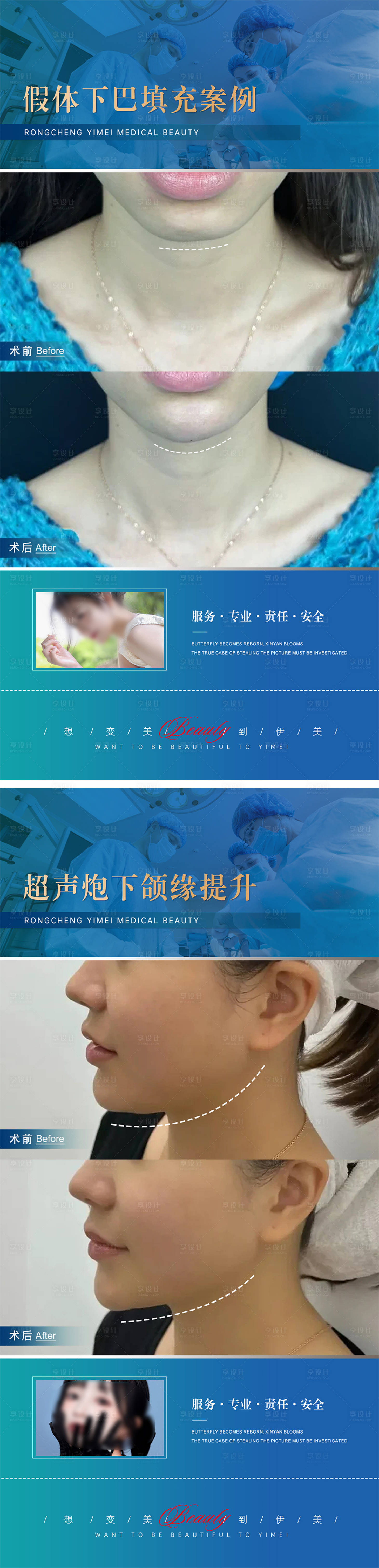 源文件下載【享設(shè)計(jì)】搜索編號(hào)：61990018406539064【醫(yī)美案例對(duì)比系列海報(bào)】