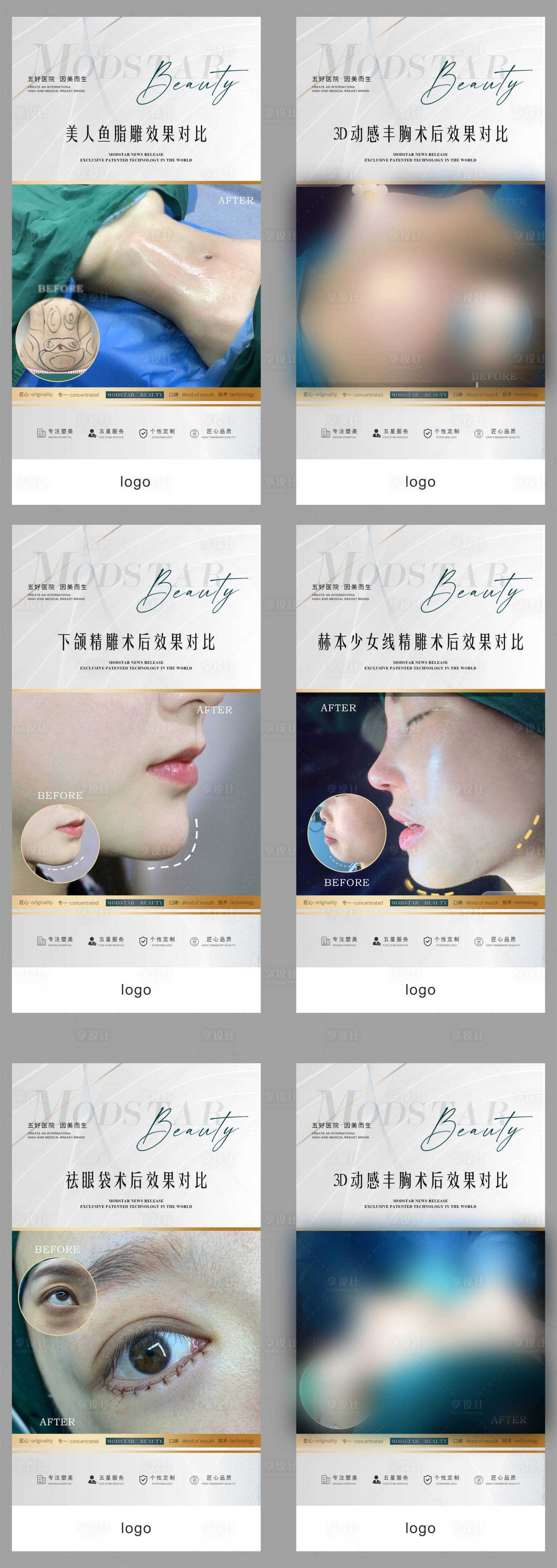 源文件下载【享设计】搜索编号：78210017885066059【医美整形美容案例对比系列海报】