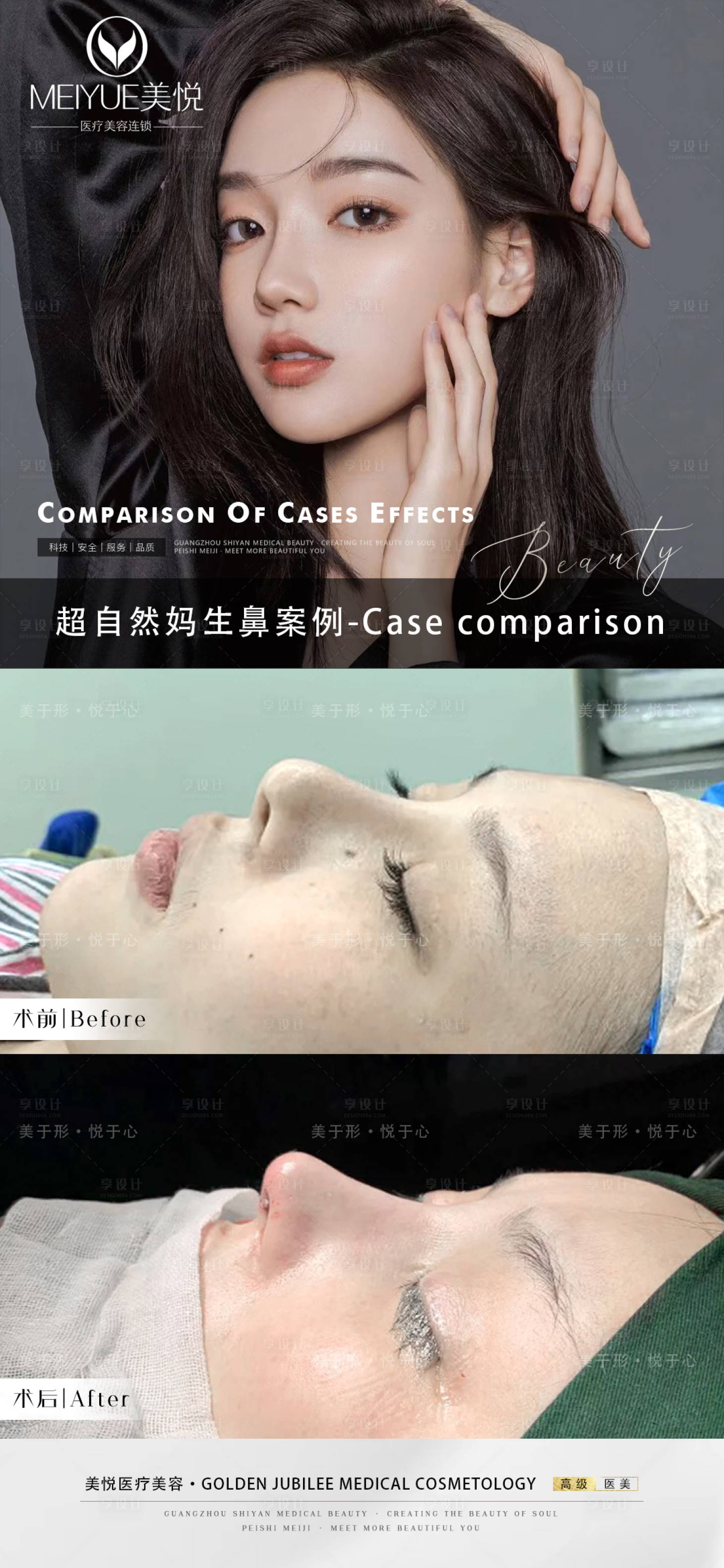 源文件下载【享设计】搜索编号：34640018294529064【医美案例】