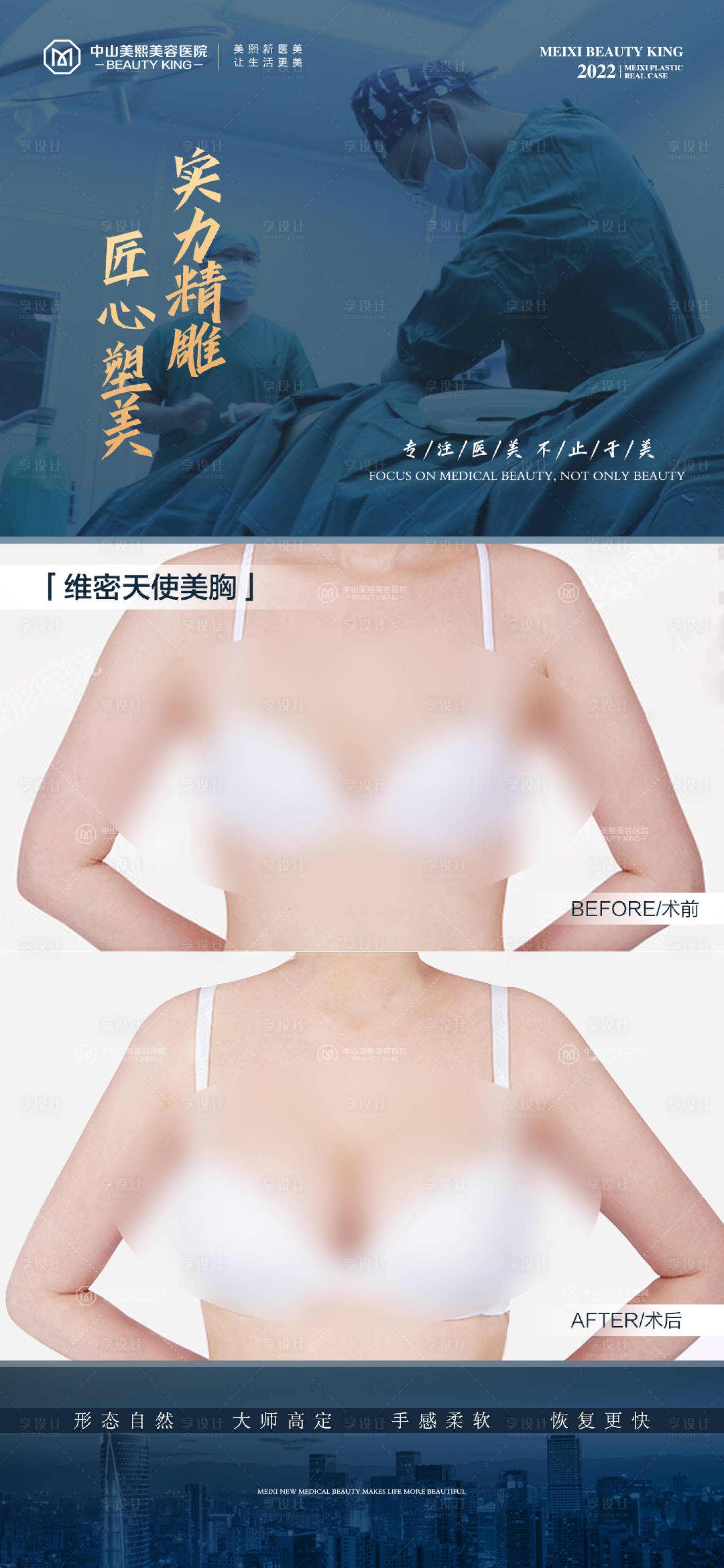 源文件下载【胸部整形案例海报】编号：74220017834752279
