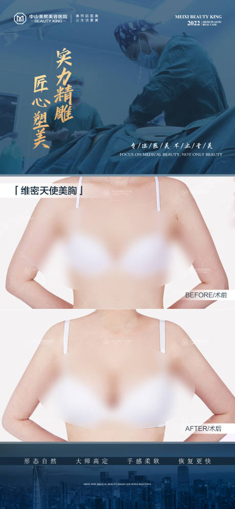 编号：20230705164753241【享设计】源文件下载-胸部整形案例海报