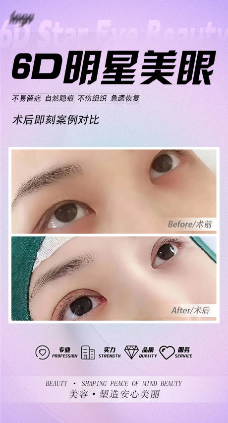 源文件下载【双眼皮案例海报】编号：97390018413618445