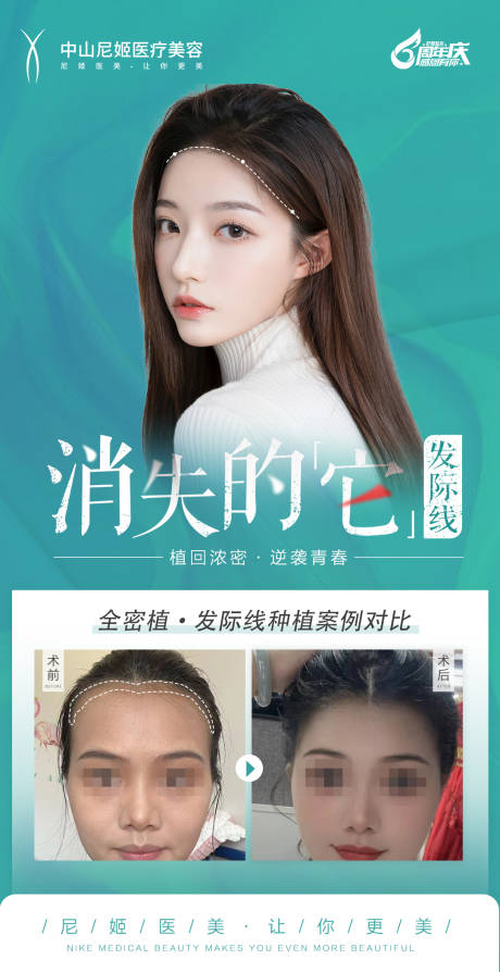 源文件下载【消失的发际线】编号：69950018133513255