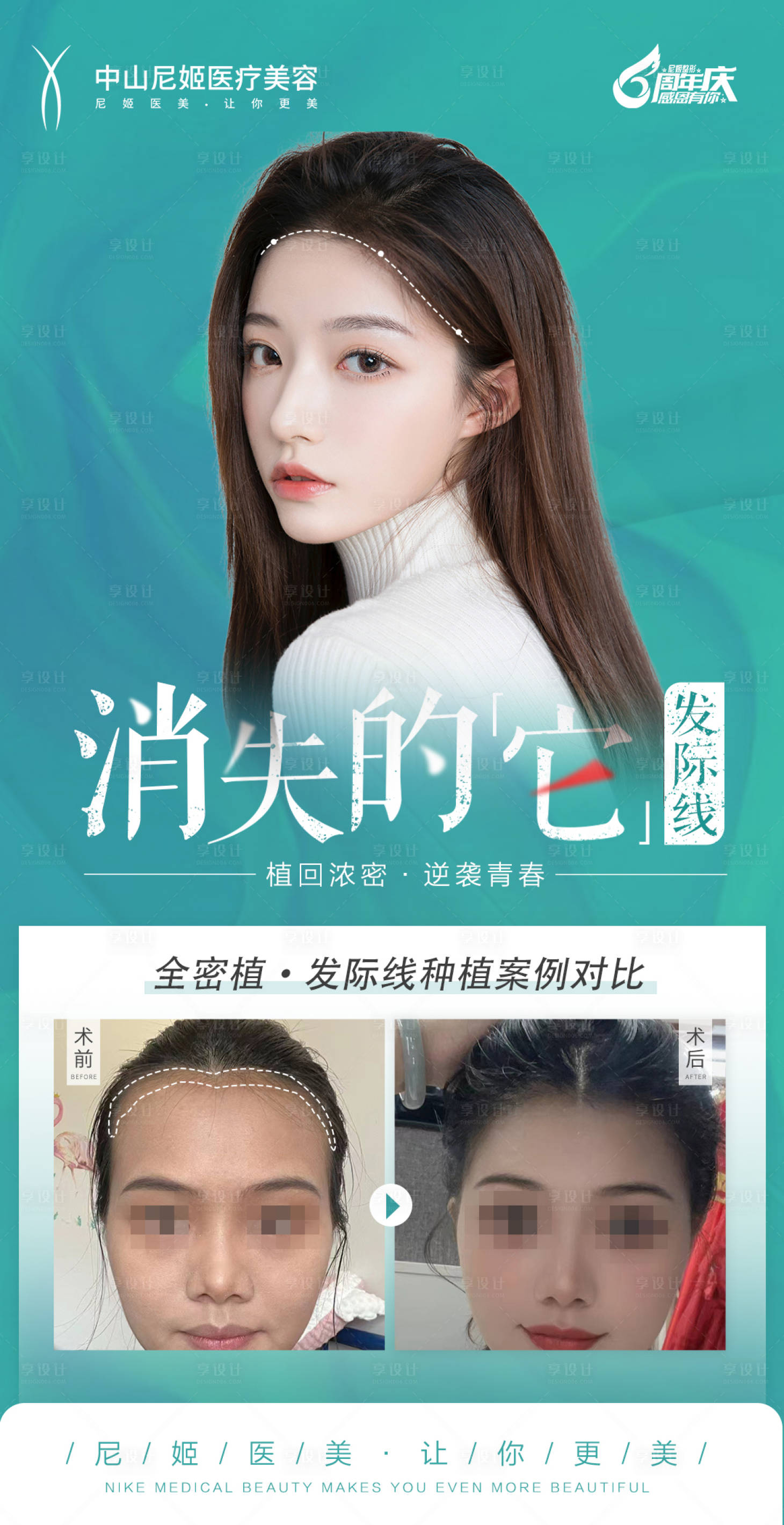 源文件下载【享设计】搜索编号：69950018133513255【消失的发际线】