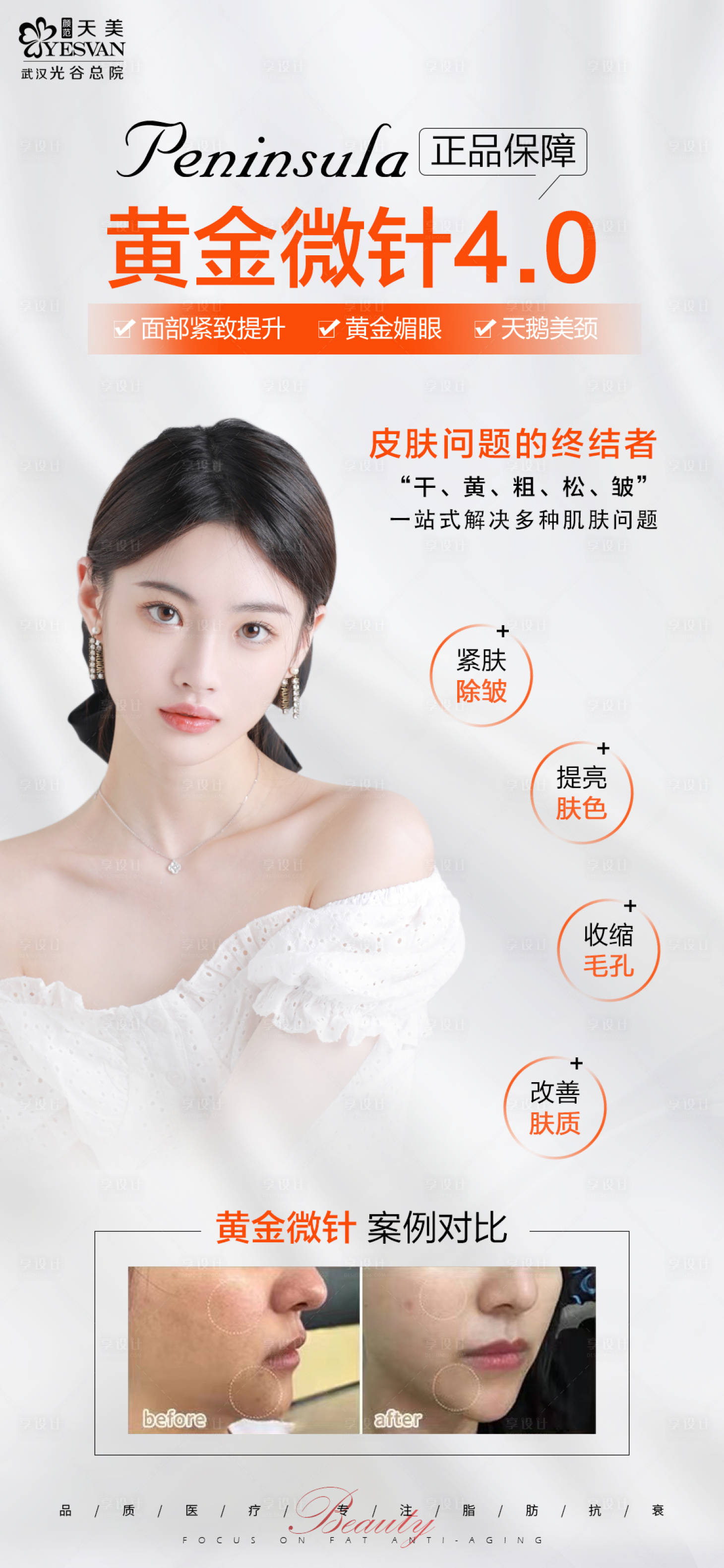 源文件下載【享設(shè)計(jì)】搜索編號(hào)：83290018020285154【黃金微針海報(bào)】