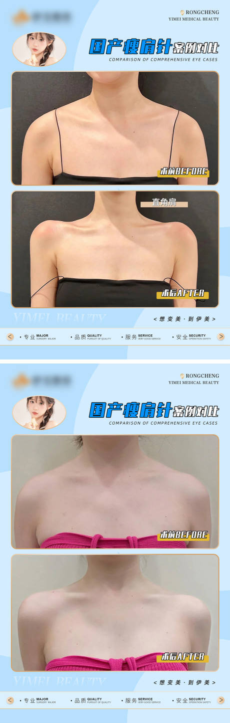 源文件下载【医美案例对比系列海报】编号：73930018227503418