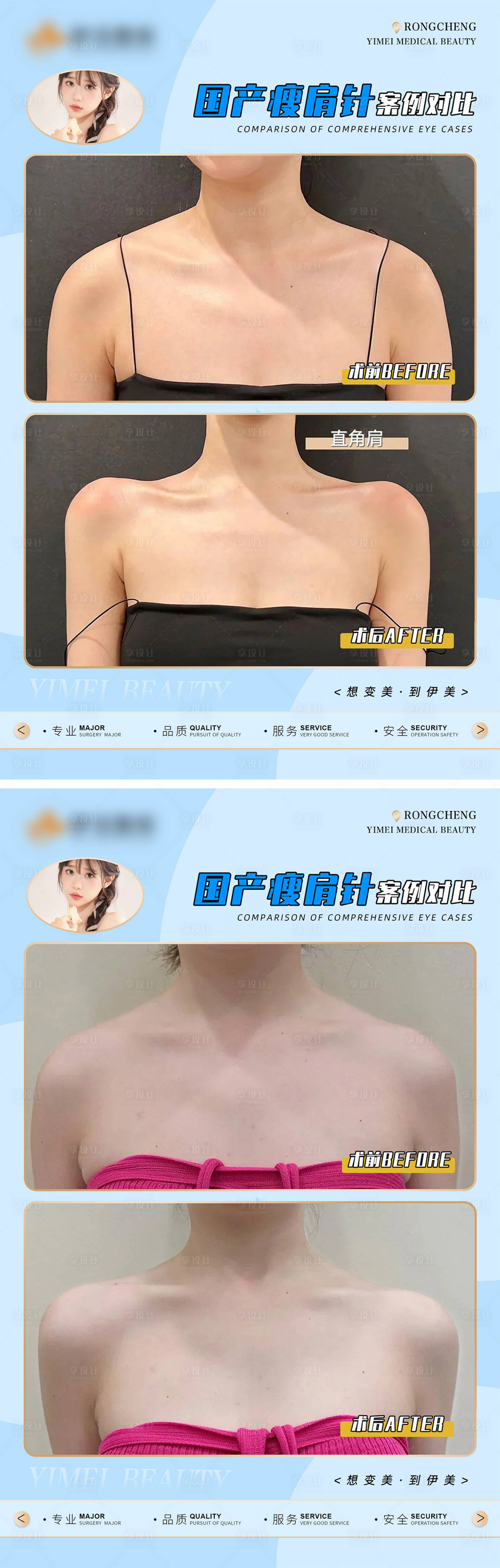 源文件下载【享设计】搜索编号：73930018227503418【医美案例对比系列海报】
