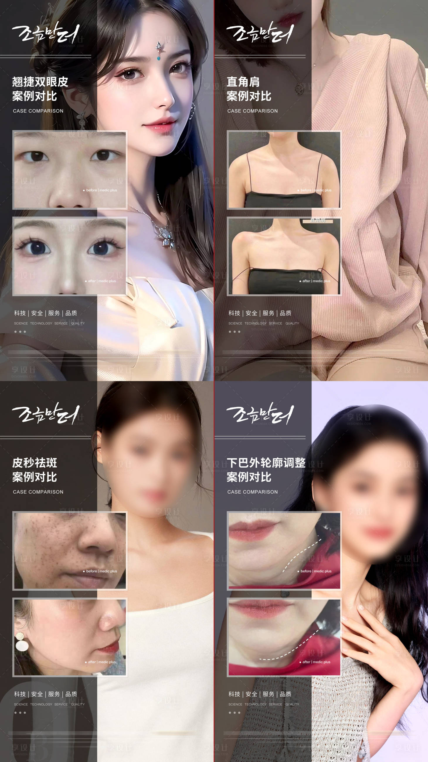 源文件下载【享设计】搜索编号：29320018008855390【医美案例】