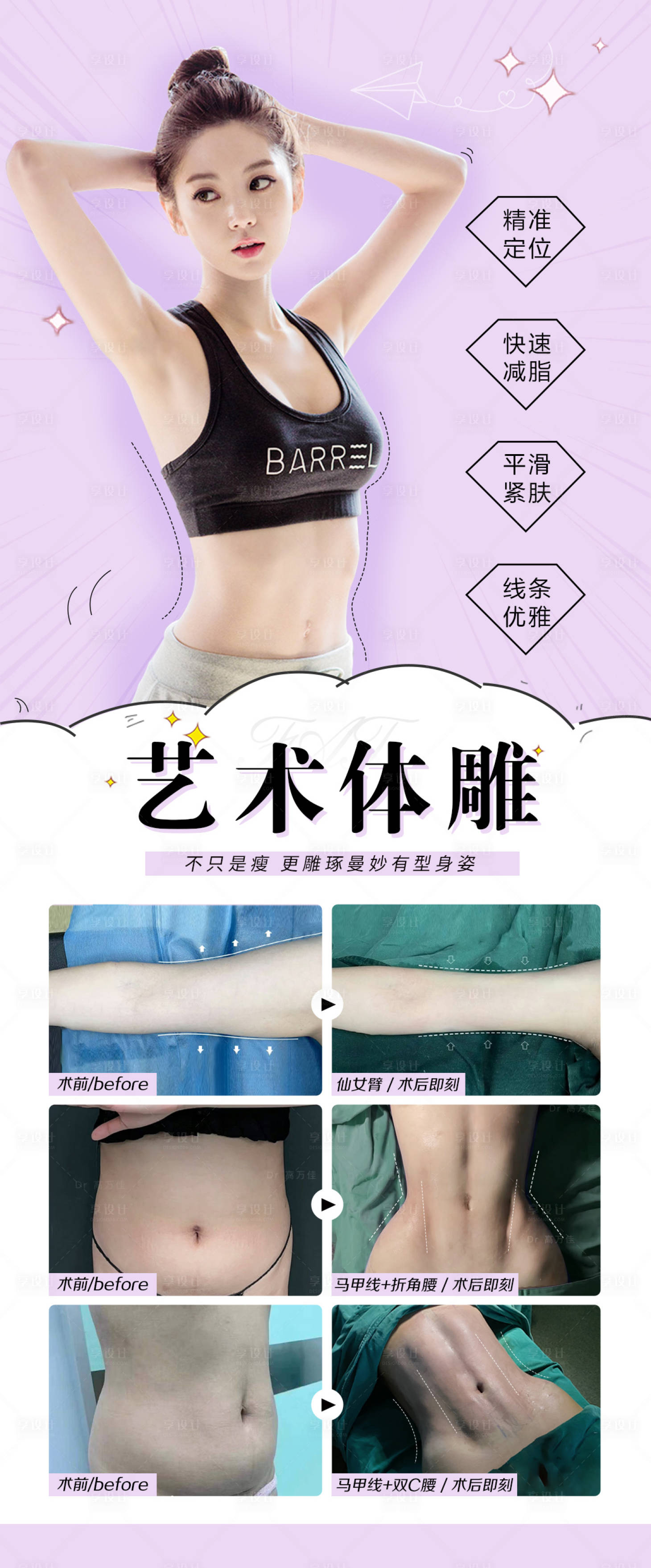 源文件下载【艺术体雕吸脂塑形整形案例】编号：19030018335678529