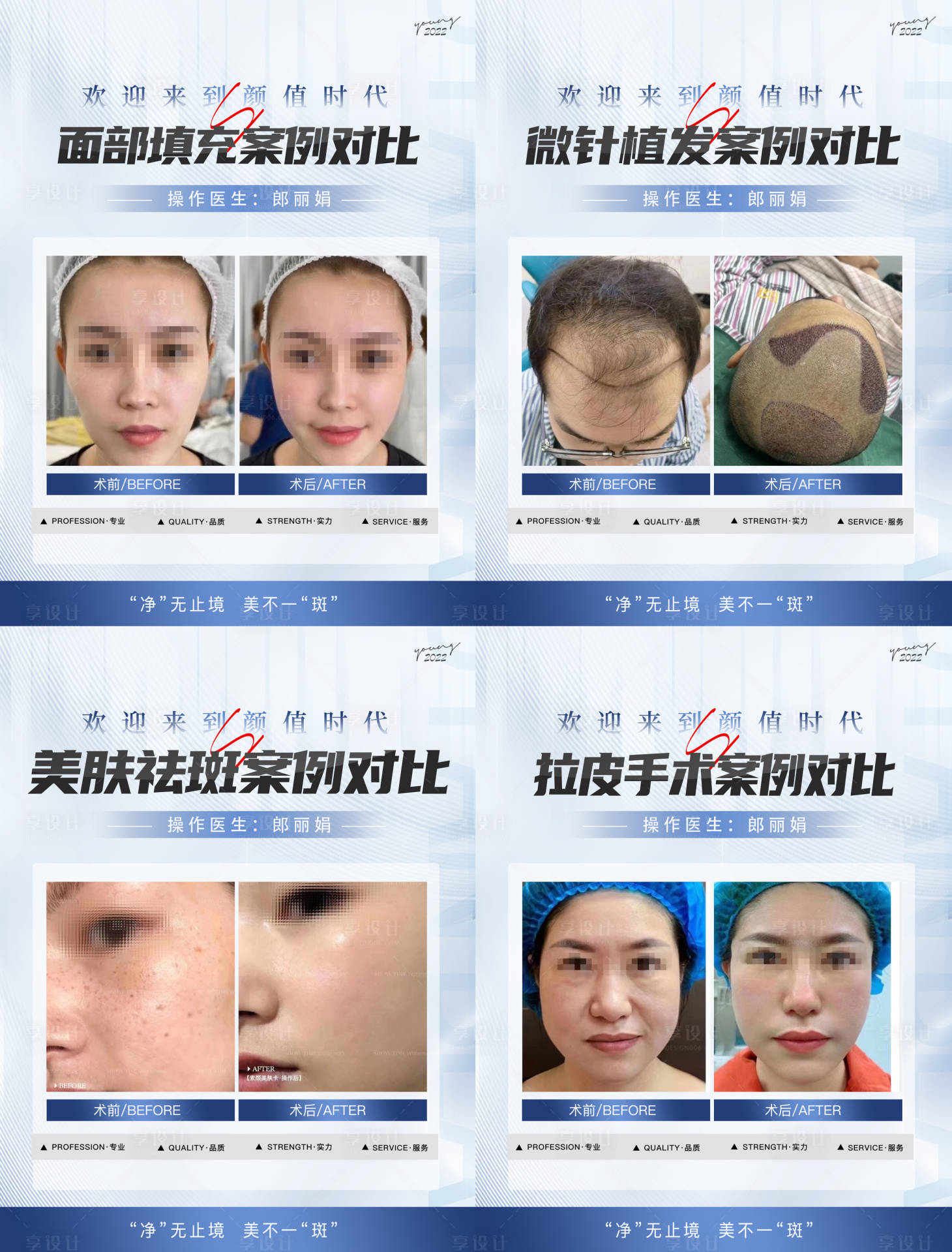 源文件下载【享设计】搜索编号：97470018080516236【整形案例植发合集】