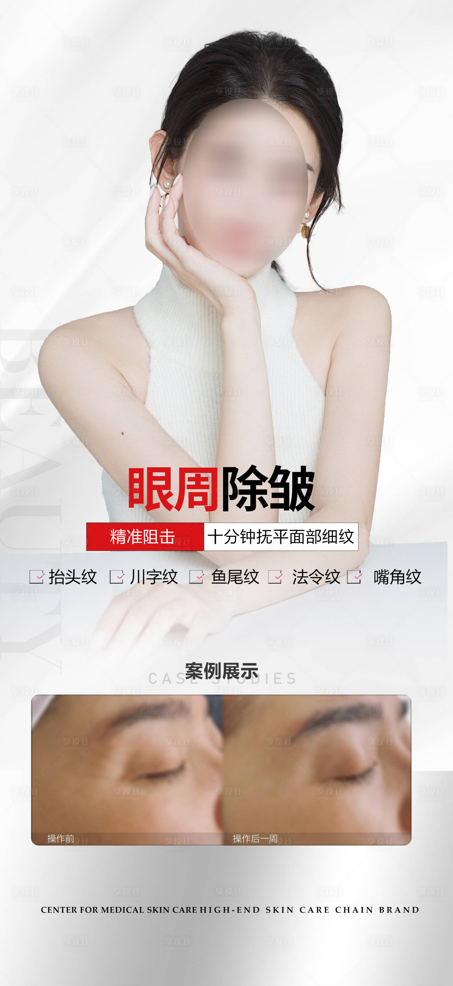 源文件下载【医美除皱海报】编号：33690018282923132