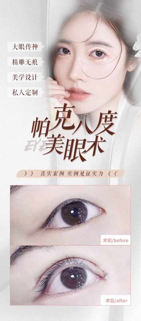 源文件下载【双眼皮眼部案例医美海报】编号：36830018058516731