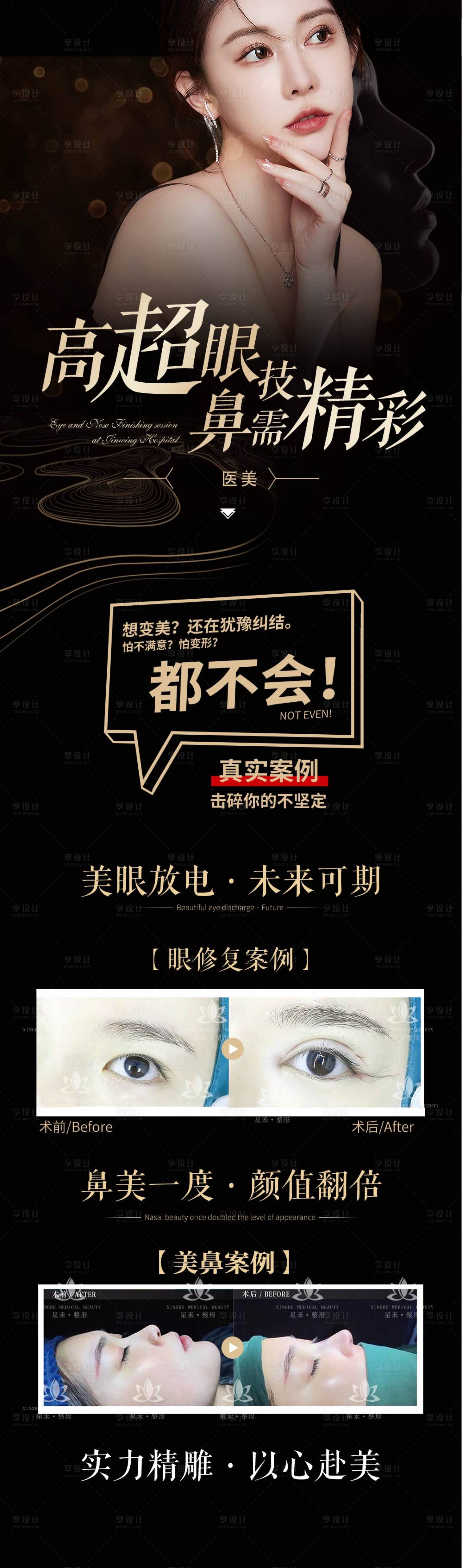 源文件下载【医美案例鼻子长图】编号：20780018123212683