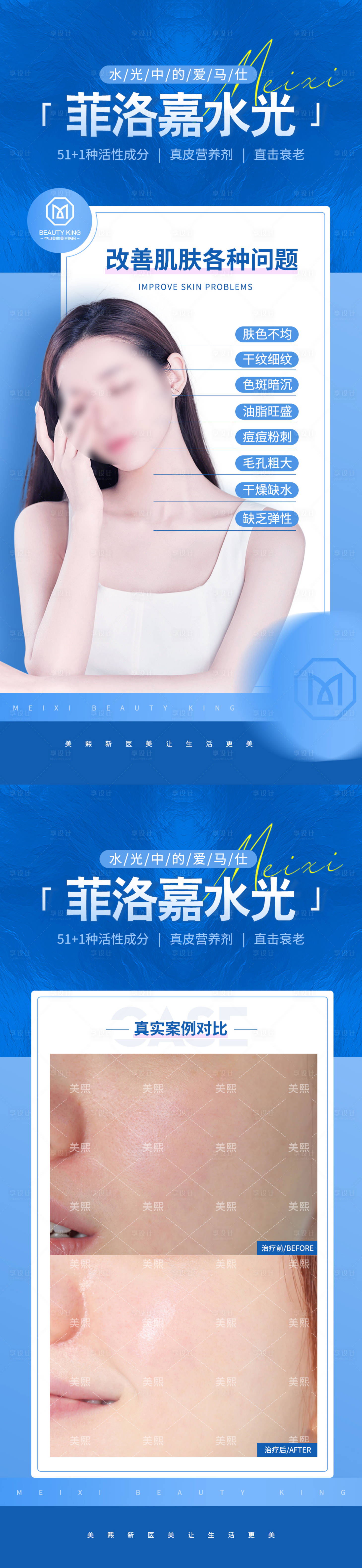源文件下載【菲洛嘉水光針海報(bào)】編號(hào)：14020018137186439