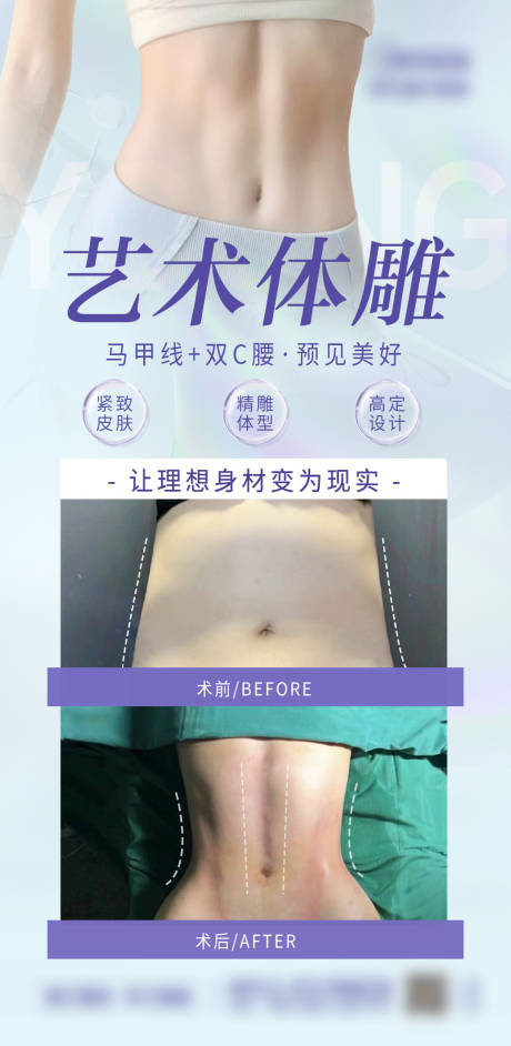 源文件下载【医美体雕海报】编号：17820017759866182