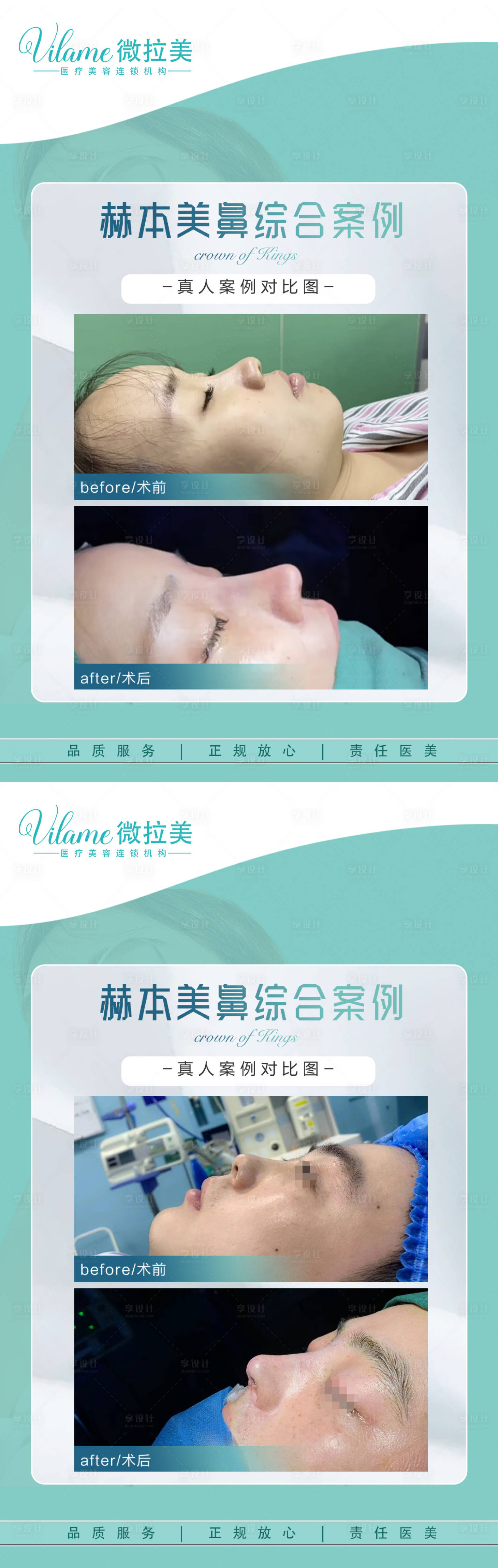 源文件下載【享設計】搜索編號：63870017985422862【醫美案例對比海報】