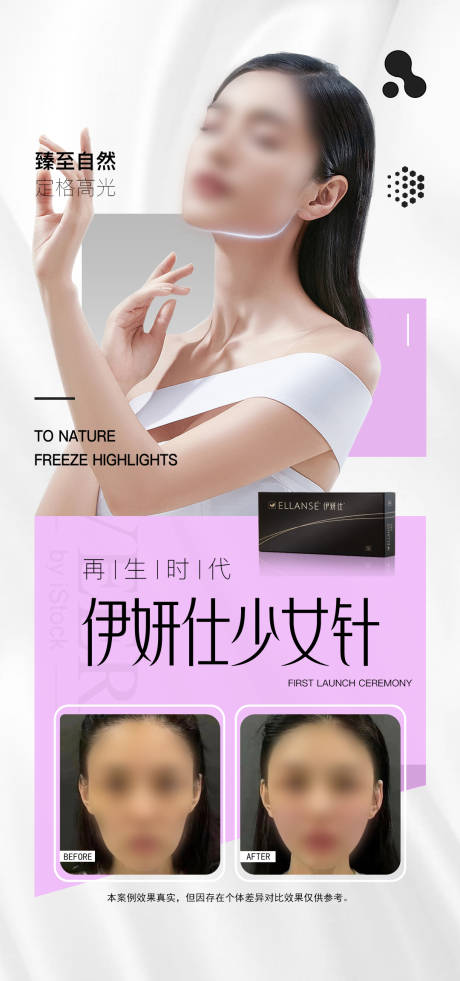 源文件下载【伊妍仕少女针】编号：13580018309746782