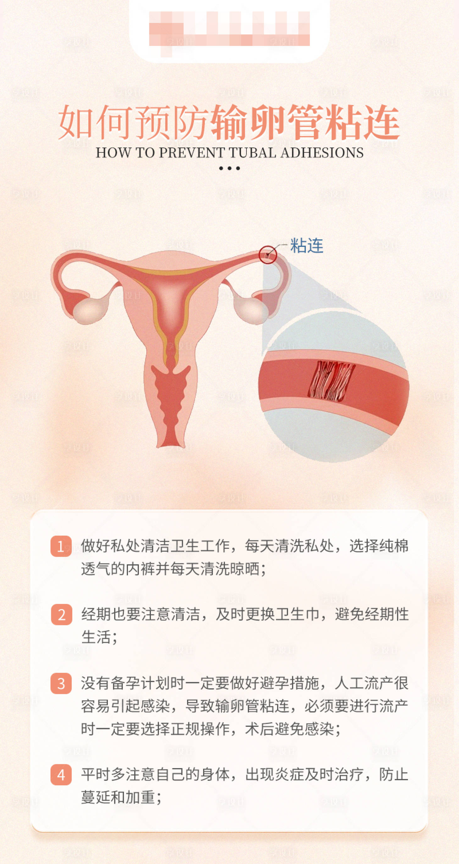 源文件下载【备孕科普海报】编号：34900018291684517