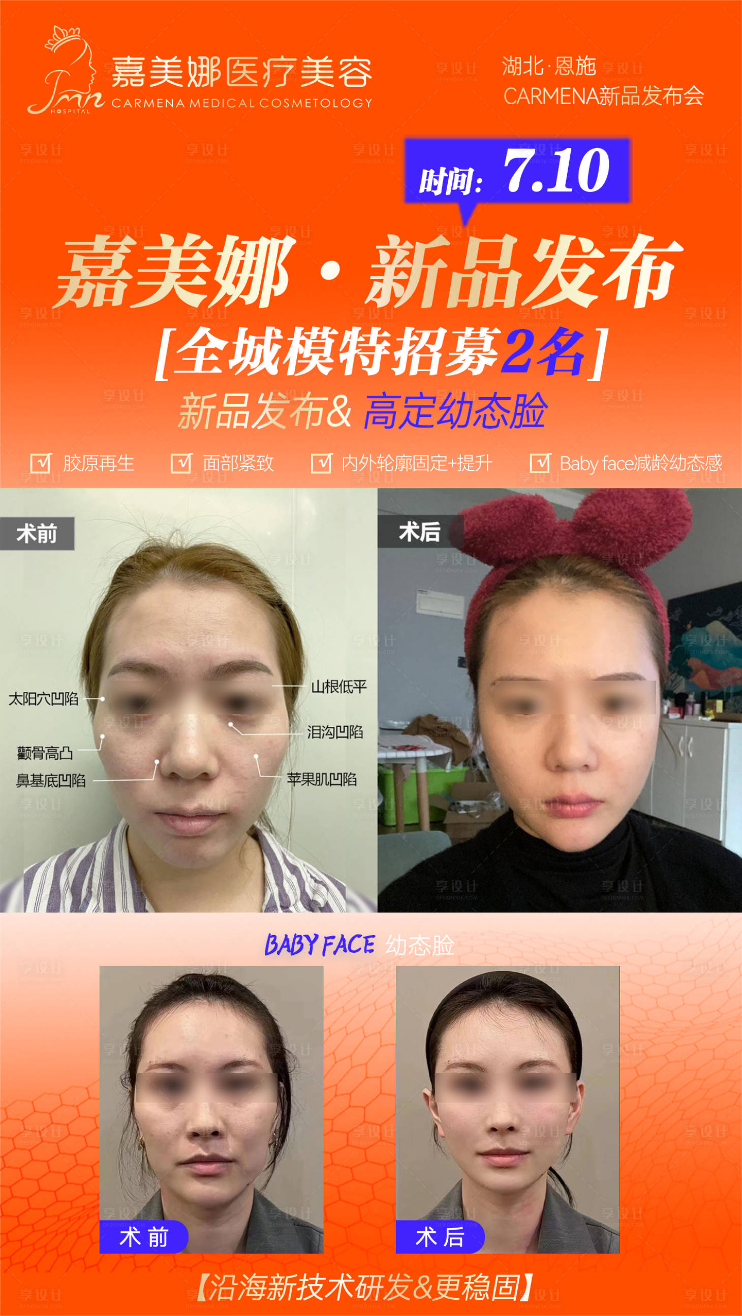 源文件下载【享设计】搜索编号：29210017875547545【医美案例海报】