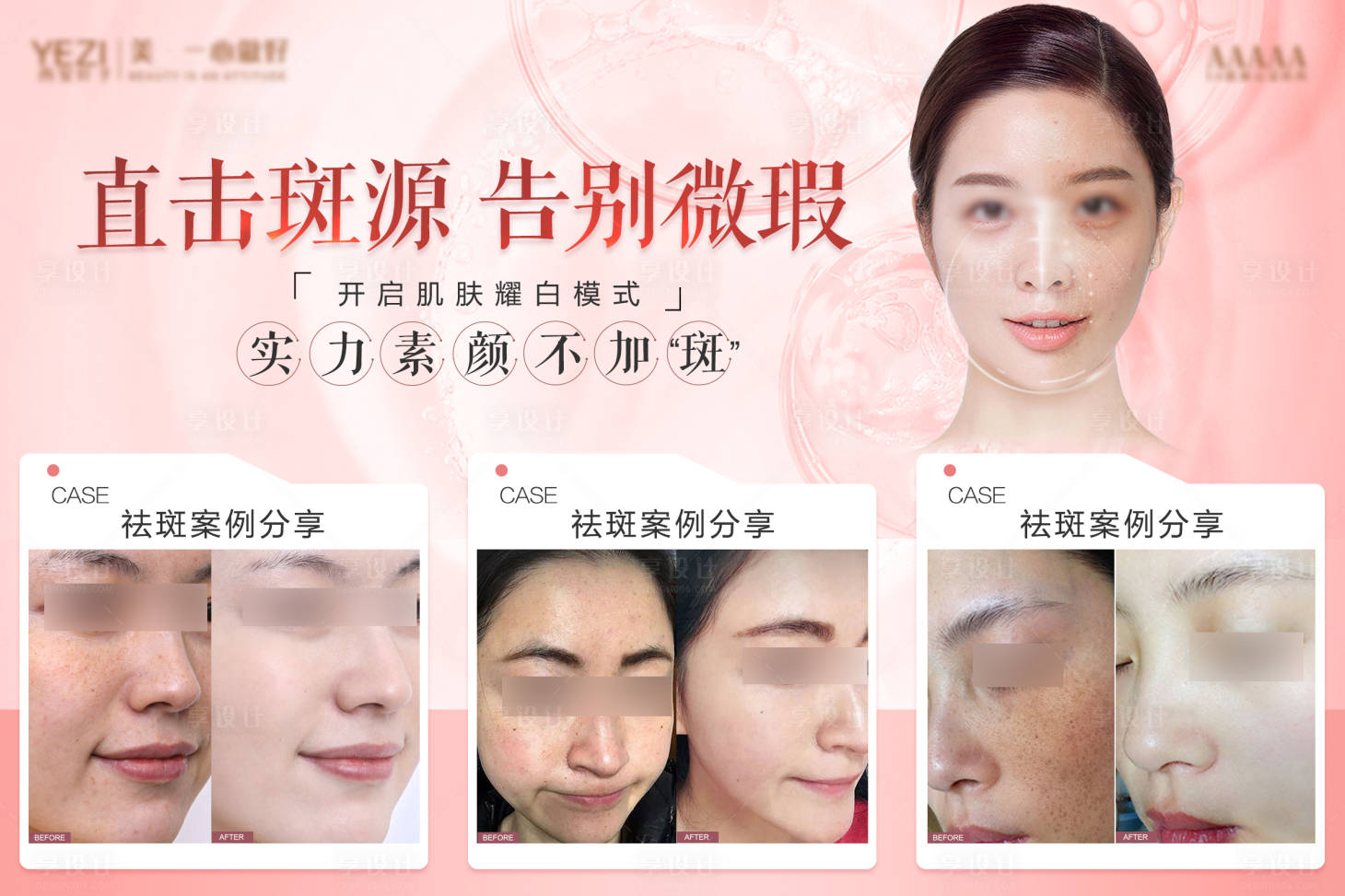 源文件下载【享设计】搜索编号：44410017831383201【整形美容祛斑海报】