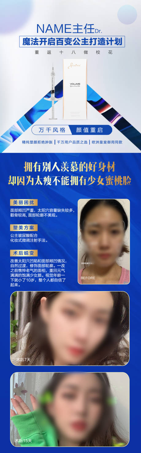 源文件下载【公主玻尿酸案例海报】编号：79740018277209033