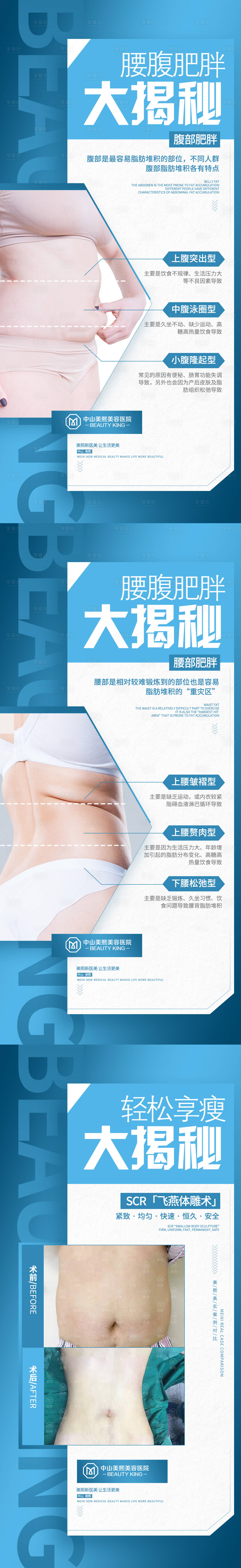 源文件下載【享設計】搜索編號：26540017748921522【腰腹肥胖大揭秘宣傳系列海報】