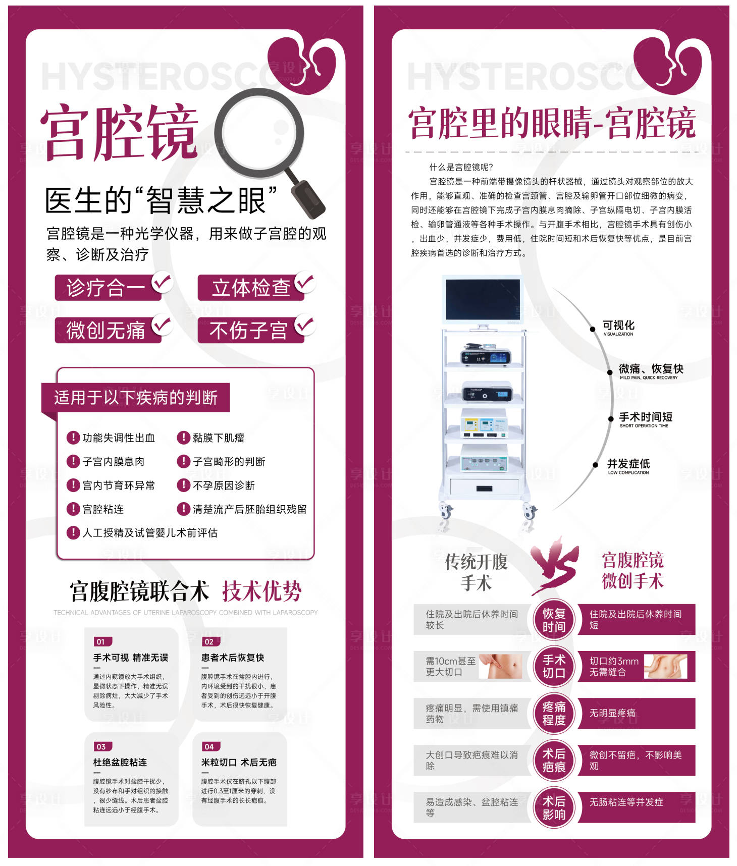 源文件下载【宫腔镜检查流程海报】编号：99310017749585955