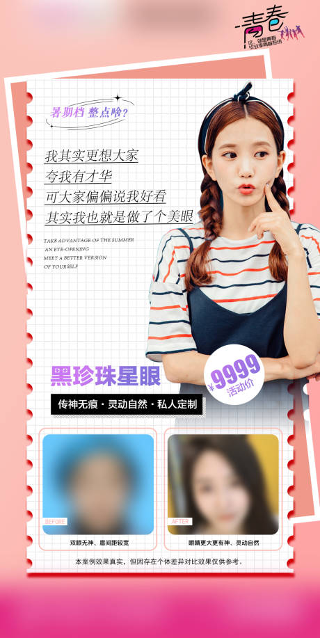 源文件下载【双眼皮眼综合】编号：68860018152632749