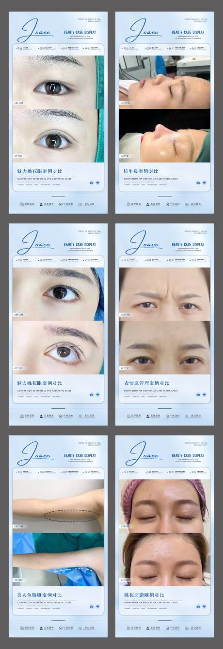 源文件下载【医美整形美容案例对比海报】编号：60640018126851013