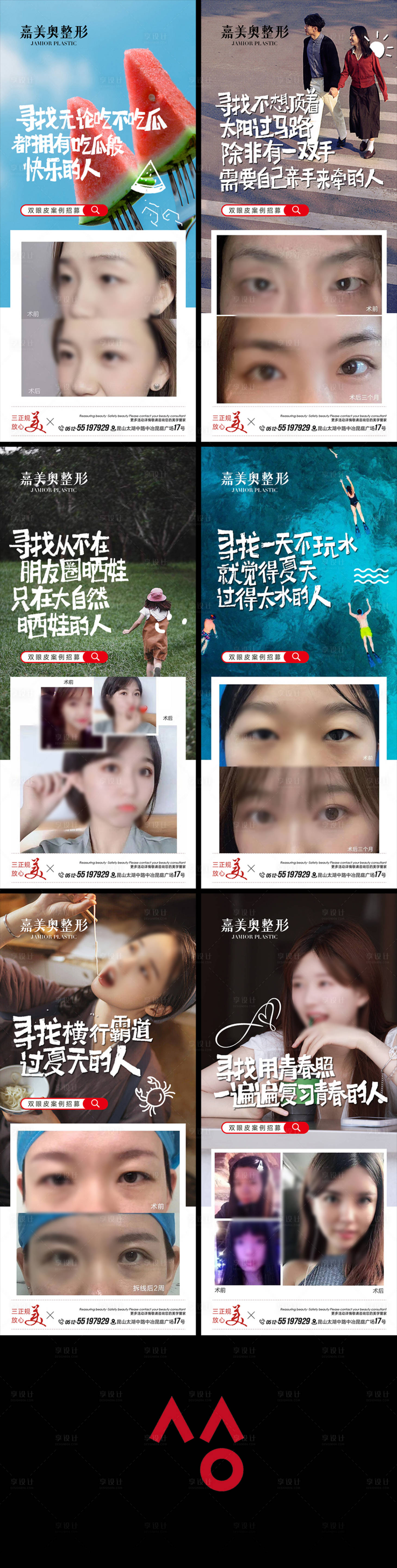 源文件下载【享设计】搜索编号：78100018076872839【双眼皮案例招募活动术前术后对比图】