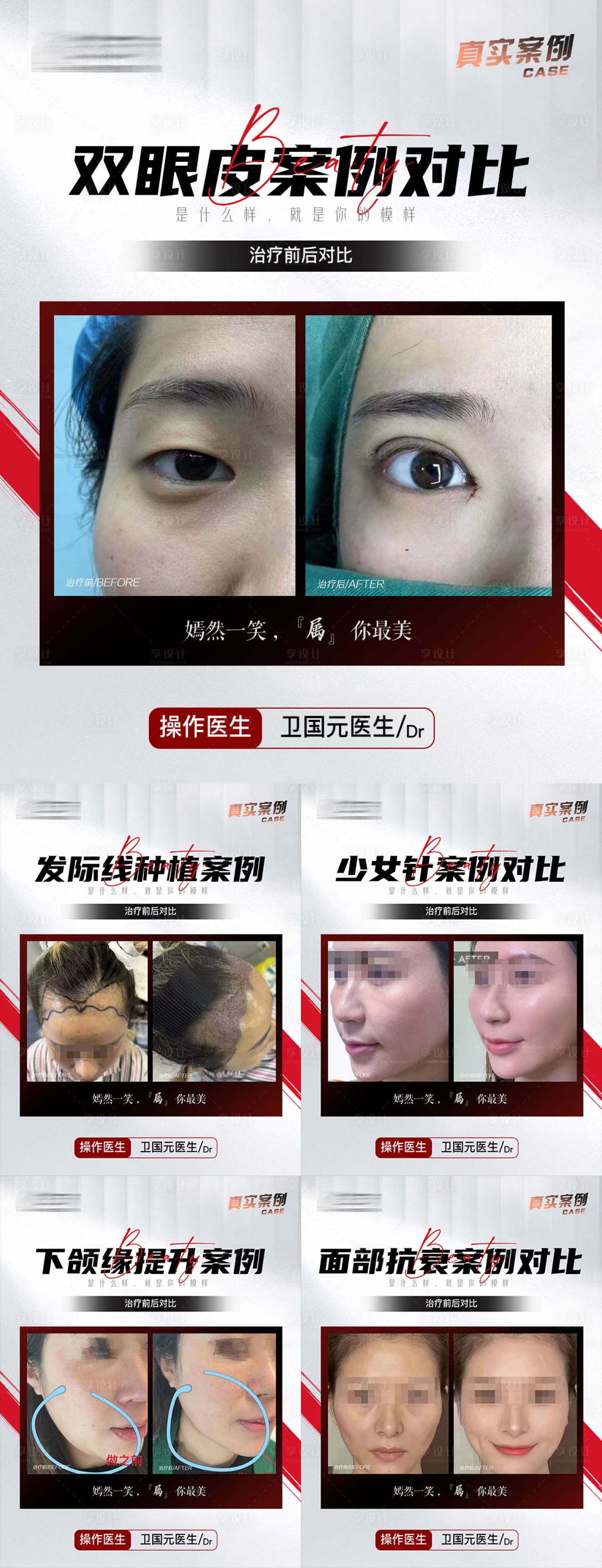 源文件下載【享設計】搜索編號：14970018092006670【醫美植發案例合集】