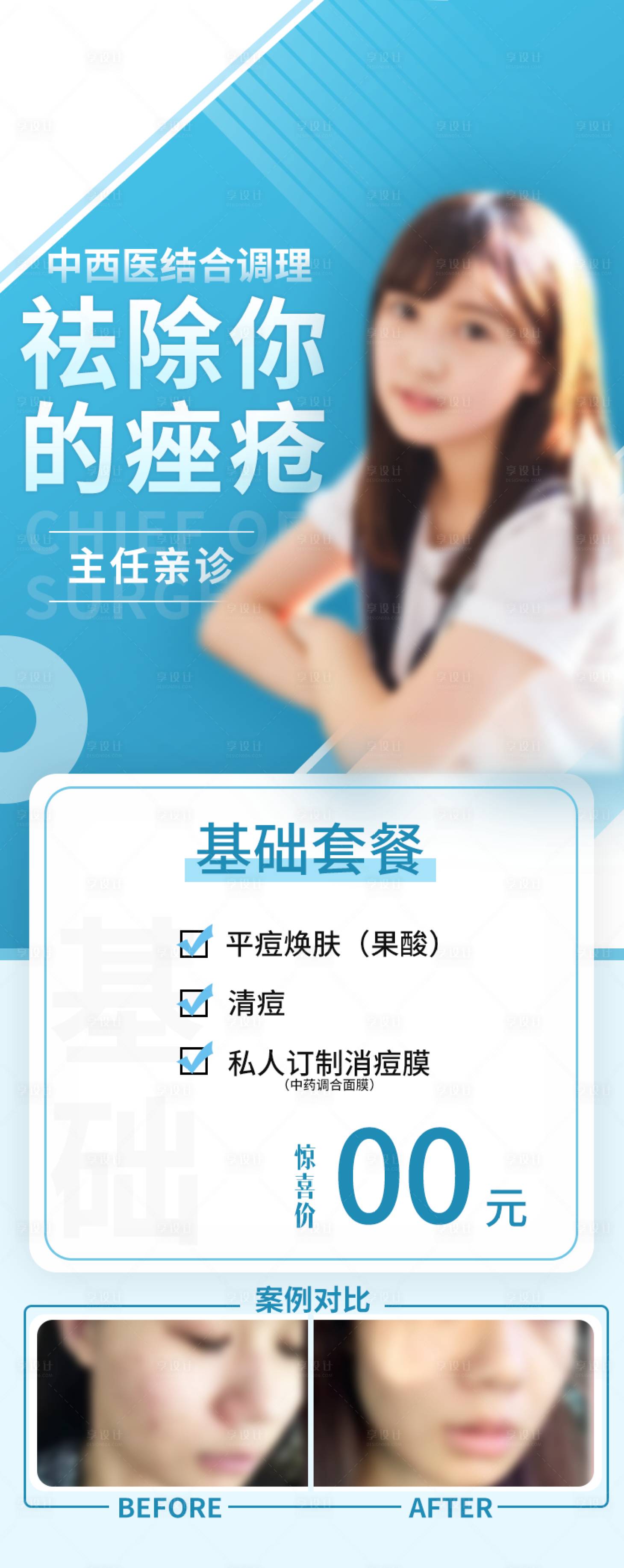 源文件下载【祛除痤疮海报】编号：21900018068994642